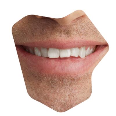 nachher51.jpg