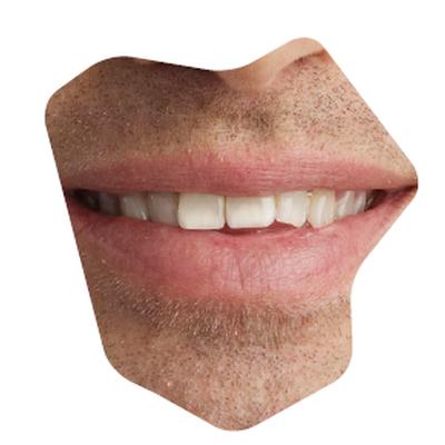 vorher5.jpg